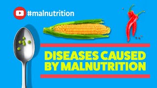 Diseases Caused by Malnutrition  SCURVY RICKETS BERIBERI PELLAGRA [upl. by Einoj]