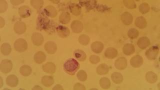 Plasmodium vivax gametocyte stage [upl. by Now]