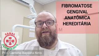 Cirurgia de remoção da Fibromatose Gengival Anatômica Idiopática Biópsia com bisturi elétrico [upl. by Arnie]