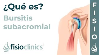 ¿Qué es la bursitis subacromial  FisioClinics Palma de Mallorca [upl. by Nonahs]