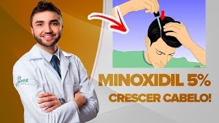 MINOXIDIL 5 PARA CRESCER CABELO E BARBA FUNCIONA MESMO  DR LUCAS FUSTINONI  Médico [upl. by Aliemaj]