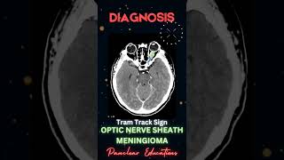 Radiology  CT Findings  High Yield MCQs  NEET PG  INICET  MRB  PYQs inicet [upl. by Akinyt]