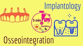 Osseointegration  Implantology  easy  lecture  5 min Dentistry [upl. by Laird]