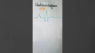 Electrocardiogram ECG shortvideo shorts viralshort youtubeshorts ecg [upl. by Siddon]