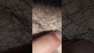 hair removal removery hairstyle haircare [upl. by Accebar]