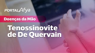 Série Doenças da mão Tenossinovite de De Quervain [upl. by Raji]