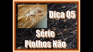 Série Piolhos Não Dica 05  Detergente Neutro piolhoselendeas voltaasaulas [upl. by Irbmac]