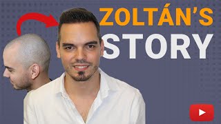 1500 Grafts Hair Transplant Journey Transforming Zoltans Hairline [upl. by Yonina418]