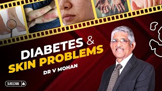 Diabetes and Skin Problems  Dr V Mohan [upl. by Buyers958]