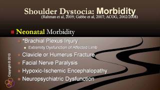 Shoulder Dystocia  Demo [upl. by Mcnamee81]