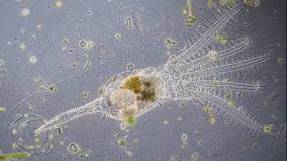 Stephanoceros fimbriatus  the most beautiful rotifer [upl. by Dillon485]