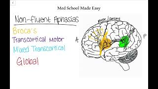 NonFluent Aphasias Made Easy How to Distinguish and Remember Them [upl. by Lasyrc611]