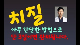 치질 단 3일에 간단히 집에서 치료하는 방법치질항문민족의술 [upl. by Mailli]