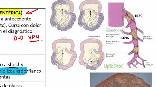 3 ABDOMEN AGUDO VASCULAR [upl. by Julianna840]