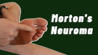 Top Progressive Exercises for Mortons Neuroma Relief  Irish Physios Guide [upl. by Renell611]