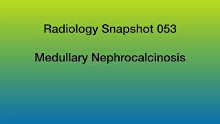 Medullary Nephrocalcinosis [upl. by Llennaj465]