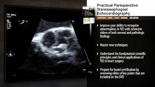 Practical Perioperative Transesophageal Echocardiography 2nd Edition [upl. by Narrat]