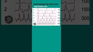 heart rate calculation from ECG  ecg heartphysiologyyoutubeshortsmedicine [upl. by Fenny]