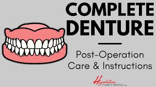 What To Do After Getting a Complete Denture  experienceHFD [upl. by Laurinda]