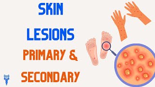 SKIN LESIONS  Primary amp Secondary [upl. by Nosrettap]