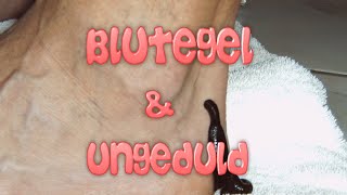 Blutegel und unsere Ungeduld [upl. by Kati359]