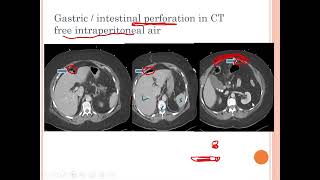 L7 Radiology GIT imaging RLM 41 [upl. by Ashti]