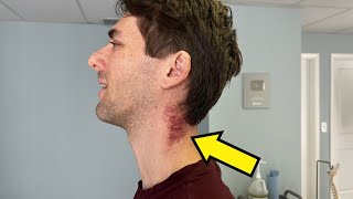 Man Goes To Doctor With A Severely FROZEN NECK 😫 Lightheaded DIZZY Ear Ringing 😫 Needs Help [upl. by Ahsehyt633]