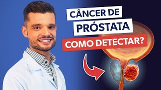 4 Exames que detectam o CÂNCER DE PRÓSTATA [upl. by Alrahs]