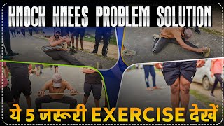 SSC GD Medical Knock Knees Problem Soution Exercises How to Cure Knock Knees  rojgarwithankit rwa [upl. by Burgener182]