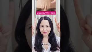 Remove Frown Lines shorts ytshorts youtubeshorts trending viralvideo facemassage [upl. by Ardnahsal]