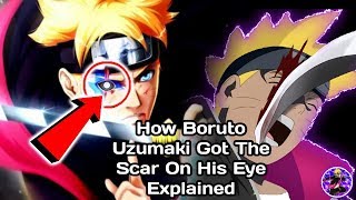 How Boruto Got The Scar On His Eye – Explained [upl. by Ahsienahs]