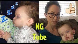 Changing NG Tube Dressings  Krabbe Leukodystrophy [upl. by Codel414]