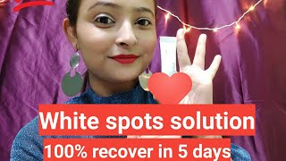 Treatment for white spots on face All in one Creams in 5days Solution done [upl. by Stout766]