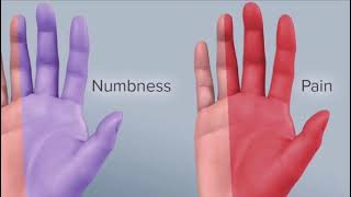 phalens test for carpal tunnel syndrome شرح بالعربي [upl. by Bottali]