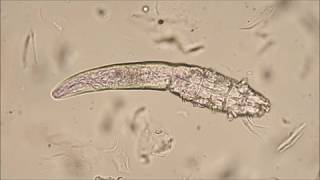 Demodex canis mites [upl. by Einial727]