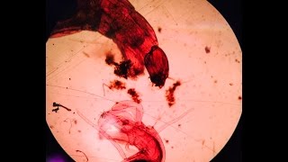 Blood Midge Larva Regurgitating Detritis [upl. by Kauppi]