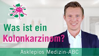 Was ist ein Kolonkarzinom  Medizin ABC  Asklepios [upl. by Caputo192]