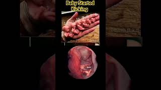 Baby Started Kicking Inside Womb Pregnancy Ultrasound V7 baby babyboy babygirl girl boy [upl. by Fillender]