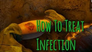 How To Treat Infection  Green Hell [upl. by Croteau]