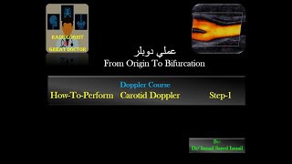 HowToPerform Carotid Doppler Step1 From origin to bifurcation [upl. by Initirb]