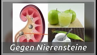 5 nützliche Hausmittel gegen Nierensteine  Besser Gesund Leben [upl. by Sivar]