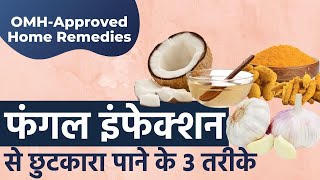 Home Remedies to Treat Urine Infection in hindi  Dr Neha Mehta [upl. by Cahilly]