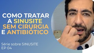 Sinusite Crônica Saiba O que é Como Tratar Sintomas e Mais [upl. by Nonie]