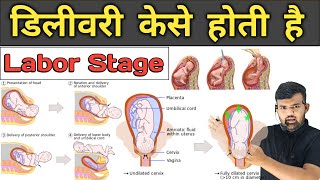 डिलीवरी केसे होती है  Labor Stage  Pregnancy  Medicine  Treatment  Hospital Knowledge  Doctor [upl. by Aniuqal]