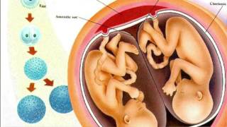 Everything You Need To Know About Fraternal and Identical Twins  Dr Sarah Finch [upl. by Akitan]