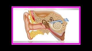 Soigner les douleurs aux oreilles [upl. by Peder]