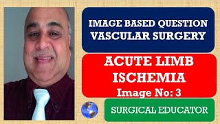 ACUTE LIMB ISCHEMIA VASCULAR SURGERY Image Based Question [upl. by Chariot759]