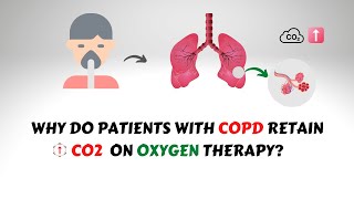 Oxygen Induced CO2 Narcosis in COPD Patients [upl. by Lever]