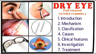 Dry Eye  Full Tutorial [upl. by Enaht]