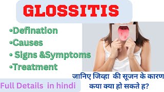 GlossitisDefinition causes signampSymptoms treatment Glossitis full Details tongue disorder [upl. by Enihsnus8]